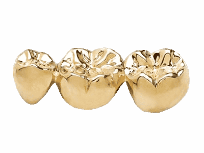 Dental Crown